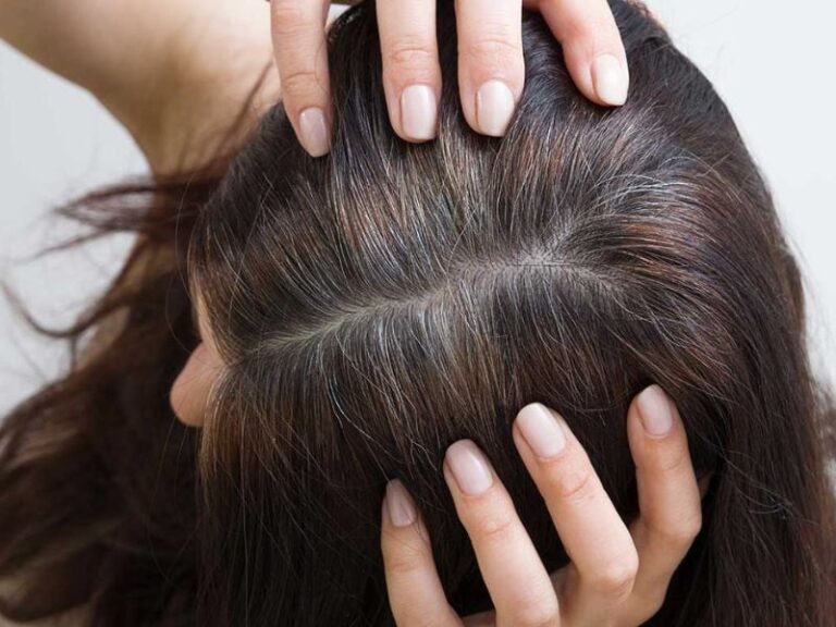 Qué tan cierto es que arrancarse una cana provoca que crezcan más